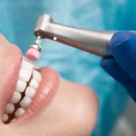 Finding The Best Dentist Milton Keynes For Your Smile