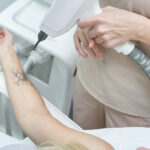 Understanding The Value Of A Free Tattoo Removal Consultation