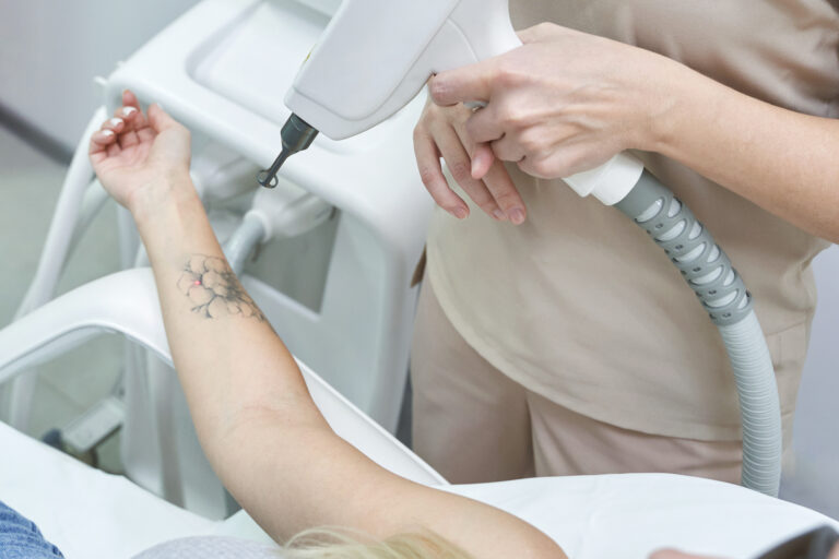 Understanding The Value Of A Free Tattoo Removal Consultation